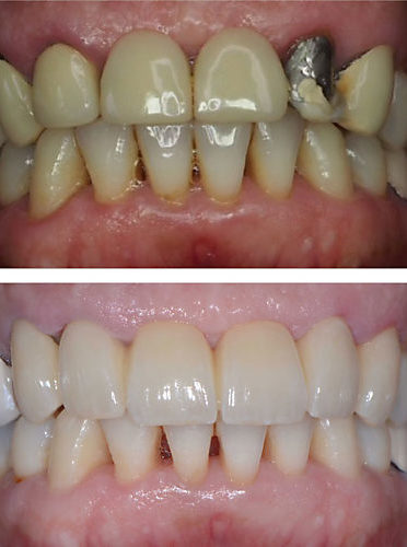 Rekonstruktive Zahnmedizin