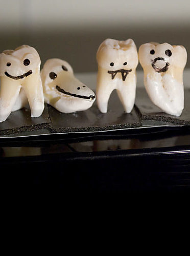 Oral Surgery | Zahnärzte im Dörfli