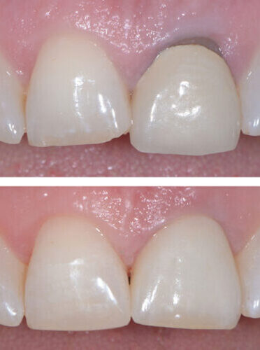 Ästhetische Zahnmedizin