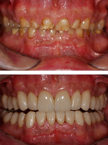 Ästhetische Zahnmedizin